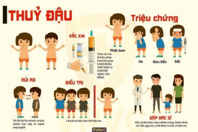Bài tuyên truyền về Bệnh Thủy đậu