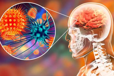 ??Chủ động trong công tác phòng chống bệnh do virut Nipah.