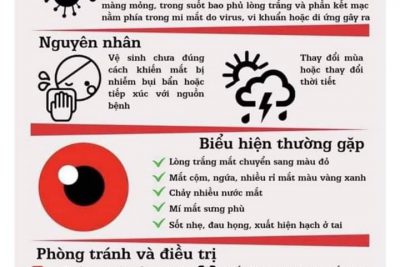 Tuyên truyền, phổ biến phòng ngừa dịch đau mắt đỏ